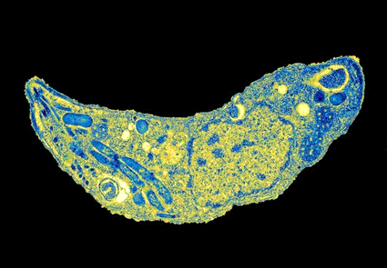 Image: Colored transmission electron micrograph (TEM) of a Toxoplasma gondii protozoan (Photo courtesy Dr. Klaus Boller / SPL).